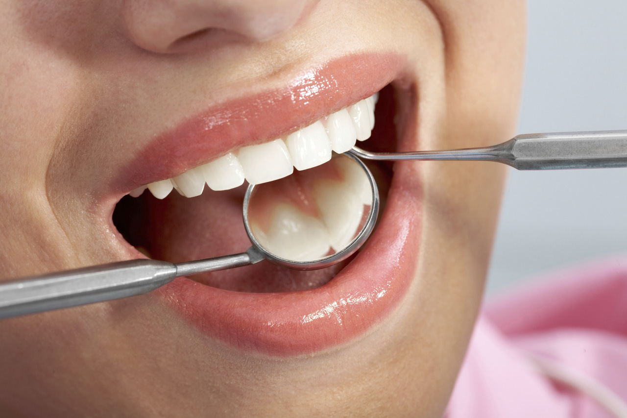 Co warto wiedzieć o implantach dentystycznych?