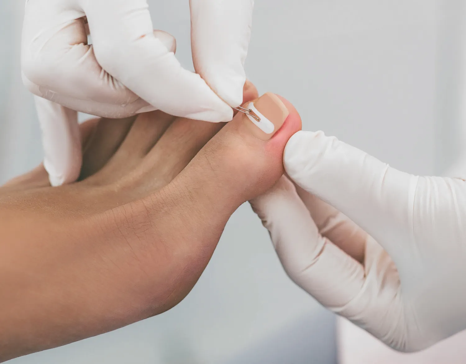 Pedicure podologiczne Warszawa