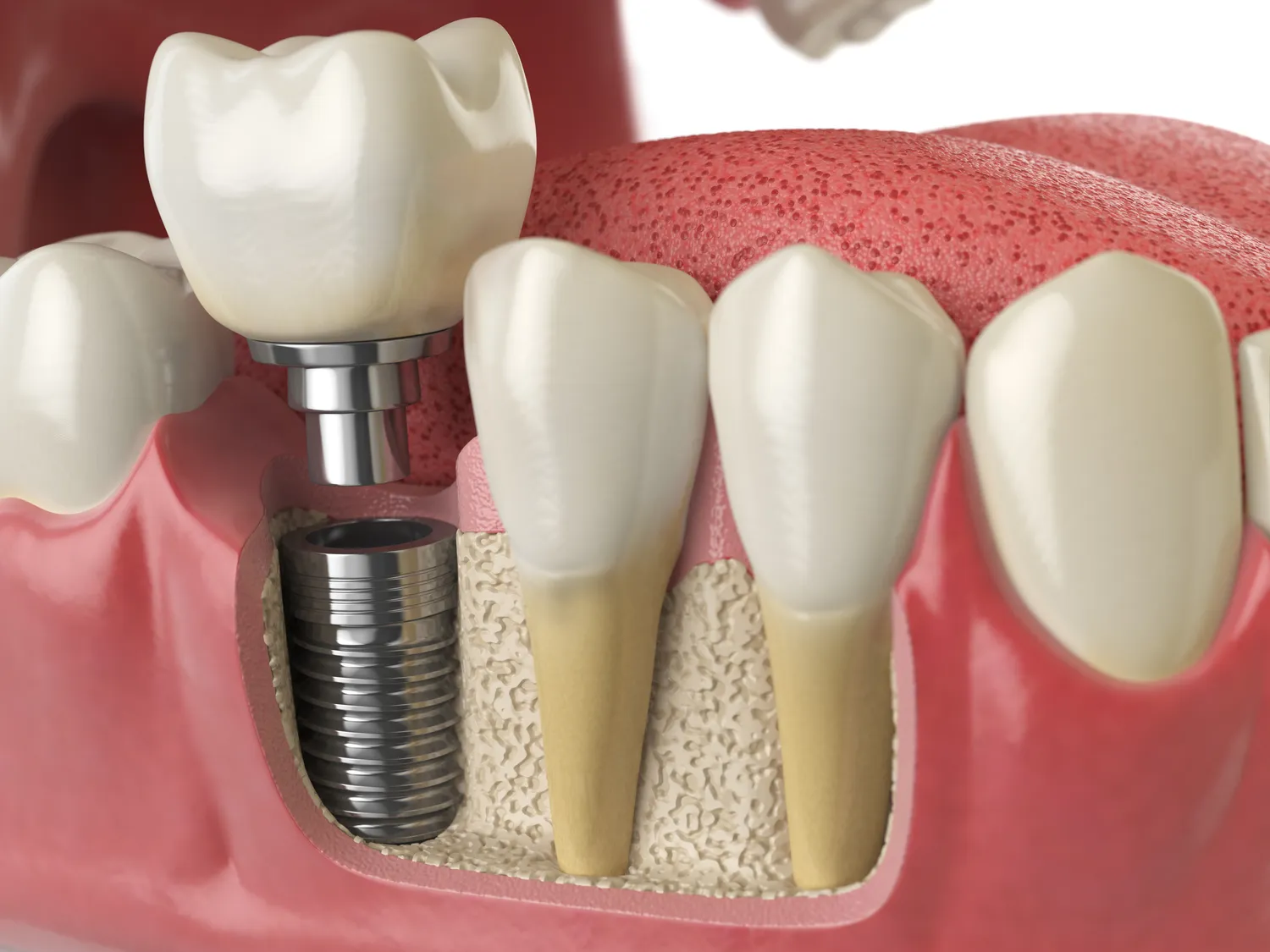 Czym się różni stomatolog od dentysty?