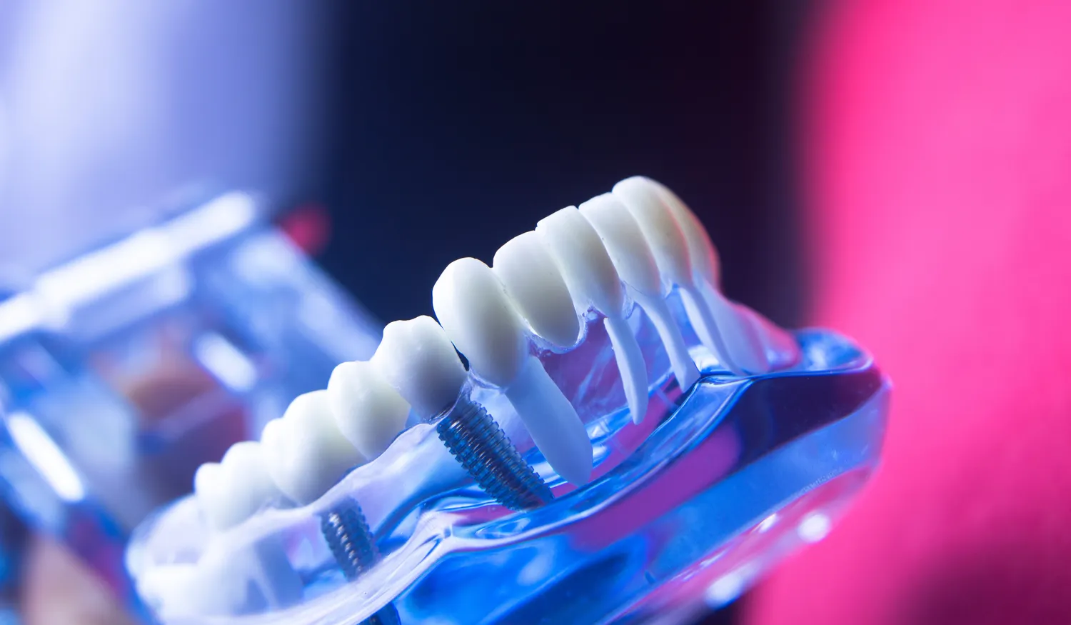dentysta-dzieciecy-szczecin-f